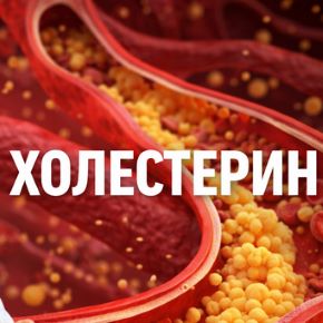 [Сергей Крук] Холестерин под контролем (2026)